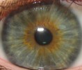 /album/iridologia/iris-jpg/