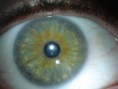 /album/iridologia/direita-jpg/